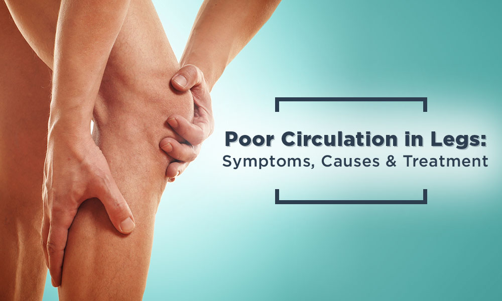 Poor Circulation in Legs:  Symptoms, Causes & Treatment